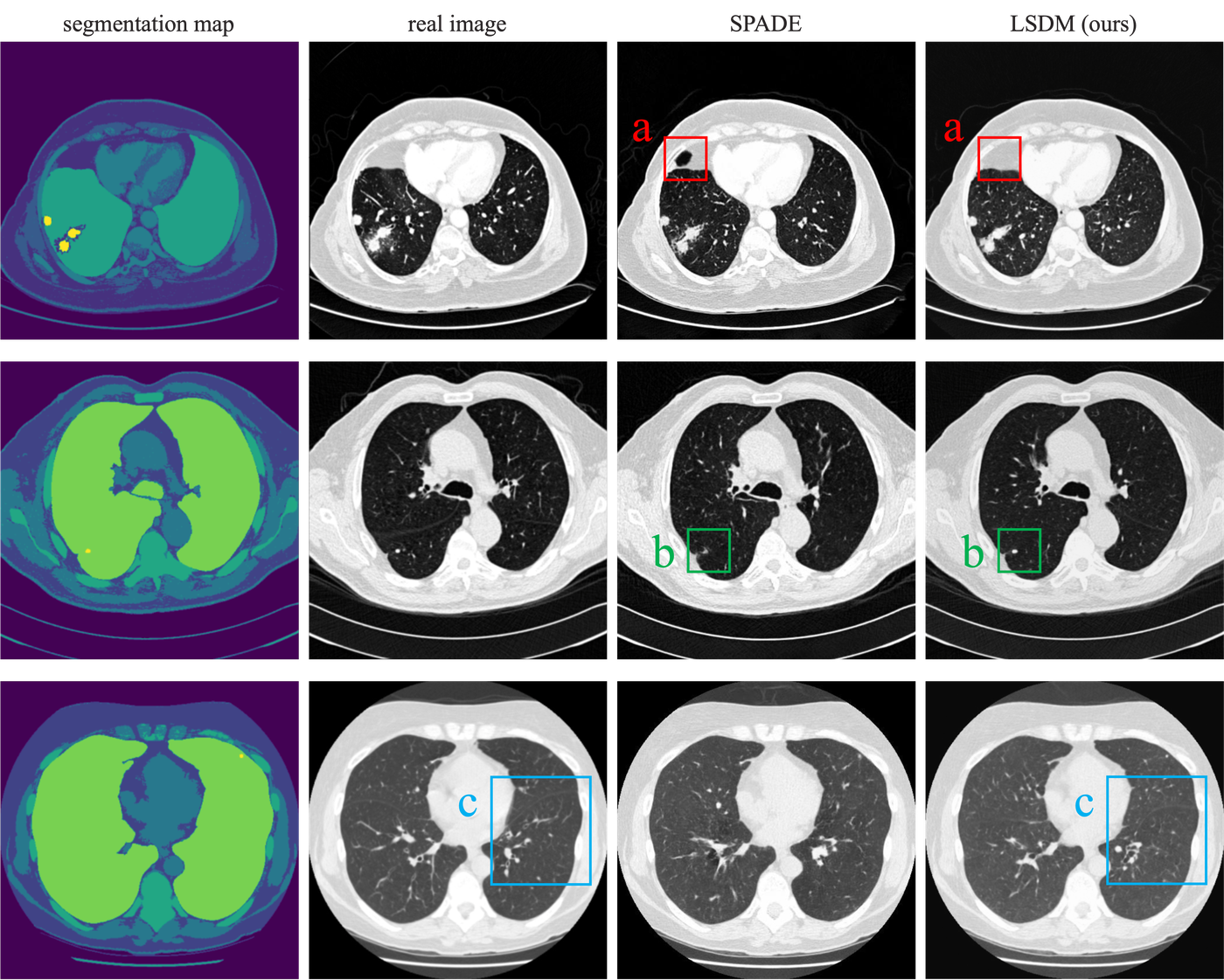 Lung CT generation compared with SPADE; note the detail at the lobe boundaries.